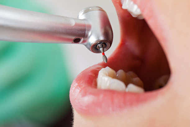 Best Emergency Cosmetic Dentistry in Prospect, OH